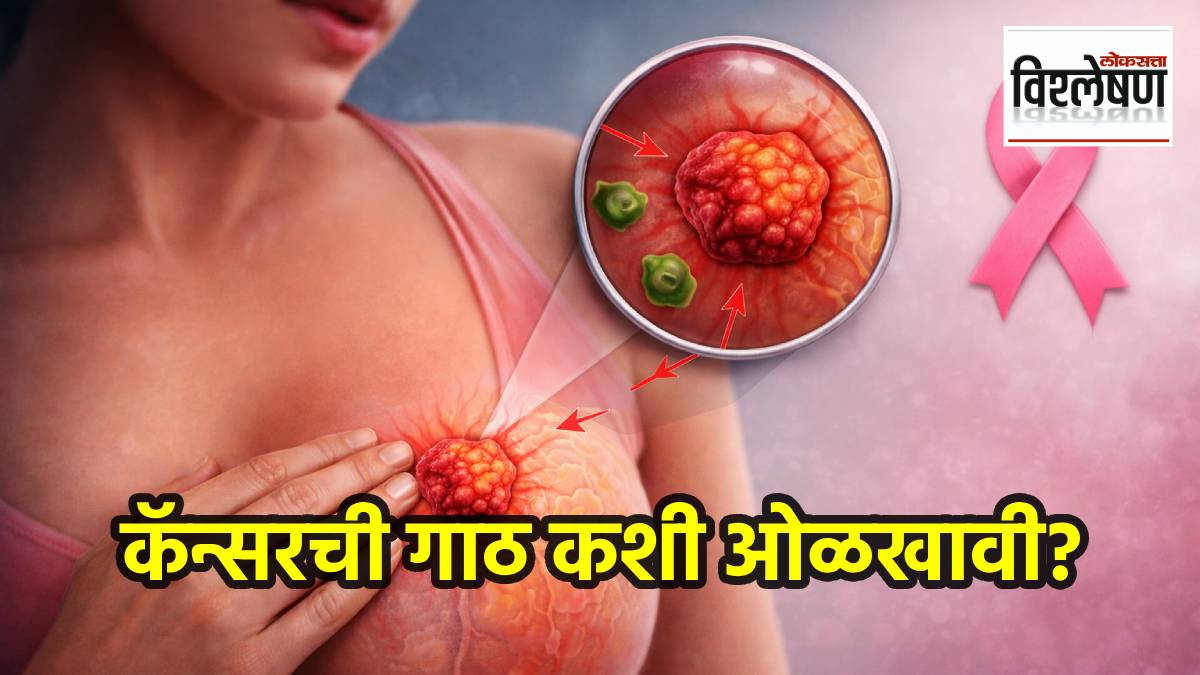 breast cancer risk increasing indian women How to identify cancerous lump
