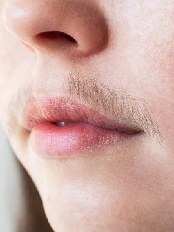 face hair removal tips