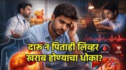 दारू न पिणाऱ्या व्यक्तींचही होतंय लिव्हर खराब? तरुणांमध्ये वाढणारा ‘हा’ आजार कोणता? तज्ज्ञ काय सांगतात?