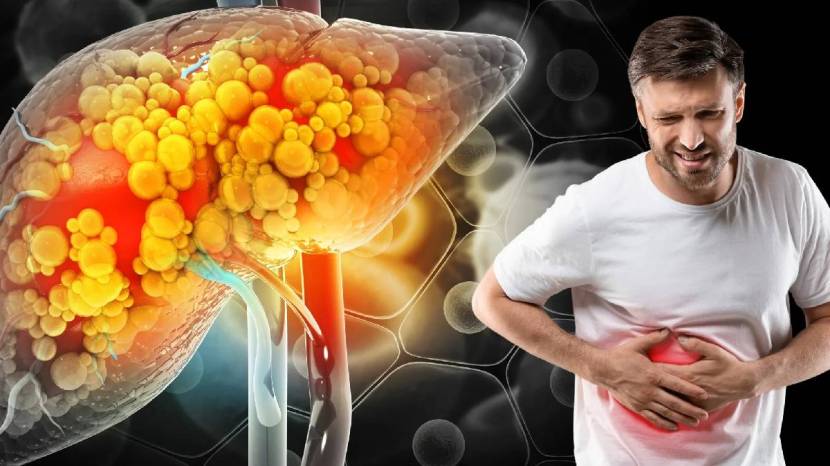 fatty liver diet if you want to get rid of fatty liver then include buttermilk banana and cabbage in your diet