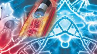 laser angioplasty news in marathi