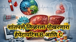 शांतपणे लिव्हरला पोखरणारा हेपेटायटिस B आणि C; वेळीच ओळखा लक्षणे आणि घ्या उपचार