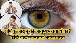 डोळे चोळण्याची सवय घातक ठरू शकते; कॉर्नियाला होऊ शकते कायमचे नुकसान