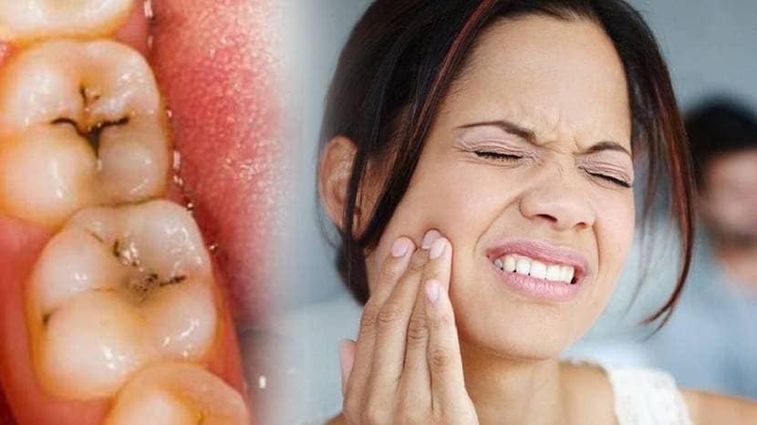 Teeth Whitening home remedy and how to remove bacteria from teeth easily healthy teeth tips