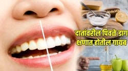 दातदुखी, दात किडणे कमी करण्यासाठी घरगुती उपाय; नारळाच्या तेलाचा फक्त ‘या’ पद्धतीने करा वापर; डॉक्टरांनी दिली माहिती…