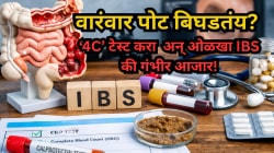 पोटाच्या तक्रारींकडे दुर्लक्ष धोकादायक! ‘4C’ फॉर्म्युल्याने ओळखा IBS की गंभीर आजार?