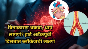 Heart Blockage Symptoms