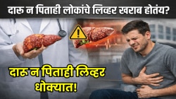 मोठा खुलासा! दारू न पिताही लोकांचे लिव्हर खराब होतंय? तरुणांमध्ये वाढतोय ‘हा’ धोकादायक आजार; डॉक्टरांनी सांगितले बचावाचे उपाय