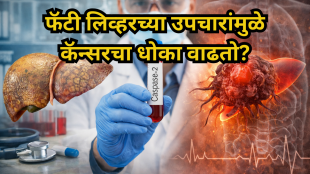 Fatty-liver-Cancer