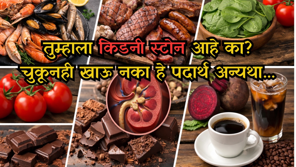 Foods to avoid for kidney stones Foods to avoid for kidney stones