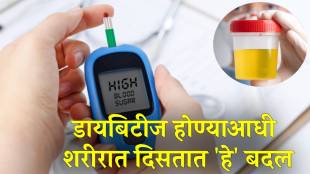 Is yellow urine sign of Type 2 diabetes