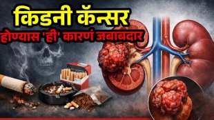 Kidney Cancer Symptoms Treatment