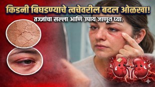 Early Signs of Kidney Disease You Should Never Ignore