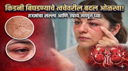 किडनी बिघडताना त्वचेवर दिसतात ‘हे’ बदल; आरशात पाहताना वेळीच ओळखा धोका, दुर्लक्ष केलं तर मोजावी लागेल मोठी किंमत…