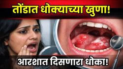 तोंडात दिसणाऱ्या ‘या’ छोट्या खुणा असू शकतात माऊथ कॅन्सरची सुरुवात; आरशात पाहताना दुर्लक्ष करू नका, नाहीतर धोका…