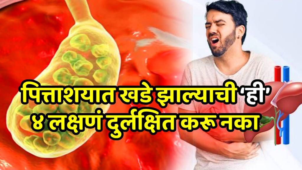 Gall bladder stone reasons causes symptoms warning signs cure treatment precautions home remedies know everything here Gall bladder stone reasons causes symptoms warning signs cure treatment precautions home remedies know everything here