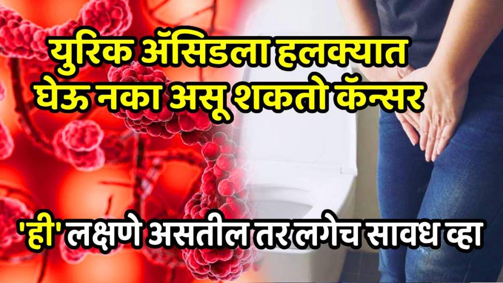 Prostate Gland Prostate Gland