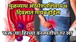 मूळव्याध ऑपरेशनशिवाय ७ दिवसात गायब होईल; फक्त ‘या’ हिरव्या वनस्पतीचा गर खा, पाइल्सला मुळापासून गळून पडेल