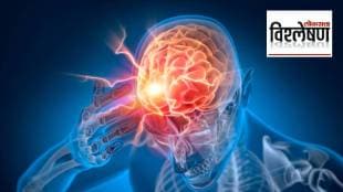 brain stroke 3 times