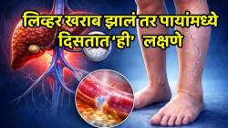 दारू न पिताही लिव्हर सडू शकते; पाय बघूनच ओळखा लिवर खराब आहे की चांगले, ‘ही’ ६ लक्षणे दुर्लक्षित करत असाल तर सावधान