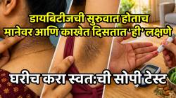 शरीरात साचलेय भयंकर साखर, डायबिटीज होण्याच्या वाटेवर आहात; मानेवर आणि काखेत दिसतात ‘ही’ लक्षणे, घरीच करा स्वत:ची सोपी टेस्ट
