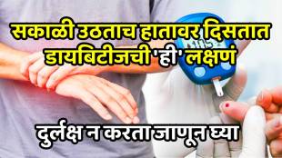 what are 3 symptoms of high blood sugar in hand know how to recognise it