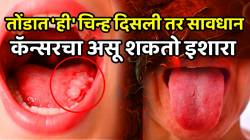 तोंडात ‘ही’ चिन्ह दिसली तर सावधान! कॅन्सरचा असू शकतो इशारा; ‘या’ अवयवांना सुद्धा होतात वेदना, वेळीच ओळखा आणि जीव वाचवा