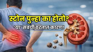 Kidney Stone Prevention Tips