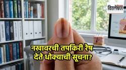 नखावरची तपकिरी रेष देते धोक्याची सूचना? असू शकतो ‘या’ कर्करोगाचा धोका; तज्ज्ञांचा इशारा काय?