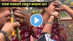किडलेला दात काढण्याचा जीवघेणा प्रकार, लोखंडी पक्कडमध्ये पकडला दात अन्…; VIDEO पाहून भरेल धडकी