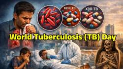 World Tuberculosis Day: मुंबई ठरतेय क्षयरोगाचे सर्वात मोठे केंद्र; MDR-TB आणि XDR-TB म्हणजे नक्की काय?