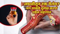लघवीतून रक्त येणं असू शकतं ‘या’ मोठ्या आजाराचं लक्षण; वेळीच ‘अशी’ घ्या काळजी