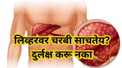 लिव्हरवर चरबी साचतेय? दुर्लक्ष करू नका; आहारात ‘हे’ ४ पर्यायी पदार्थ घेतल्यास फॅटी लिव्हरचा धोका कमी होऊ शकतो
