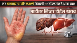 जर हातावर ‘अशी’ लक्षणे दिसली तर डॉक्टरांकडे धाव घ्या! नाहीतर, थेट लिव्हर होईल खराब; वेळेत निर्णय घेतला तर वाचेल जीव…