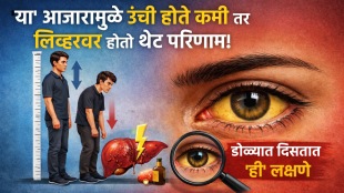 liver disease symptoms in eyes shrinks height by foot warning sign of liver damage