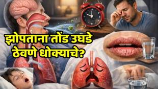 Man sleeping with mouth open showing signs of mouth breathing.