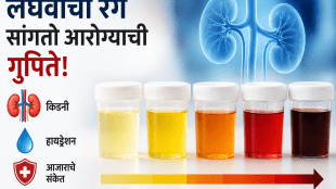 signs of kidney hydration and disease from the color of urine