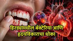 दात घासताना हिरड्यांतून रक्त येतंय? दुर्लक्ष करू नका, हृदय, किडनीवर होऊ शकतो गंभीर परिणाम; डॉक्टरांचा मोठा इशारा