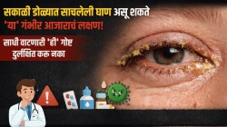 सकाळी डोळ्यात साचलेली घाण असू शकते ‘या’ गंभीर आजाराचं लक्षण! साधी वाटणारी ‘ही’ गोष्ट दुर्लक्षित करू नका, नाहीतर…