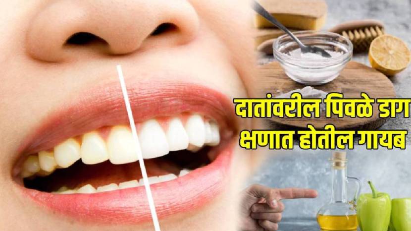 Effective teeth whitening at home