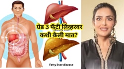 हृतिक रोशनची बहीण सुनैना रोशनने ग्रेड ३ फॅटी लिव्हरवर कशी केली मात? डॉक्टरांनी सांगितली योग्य पद्धत