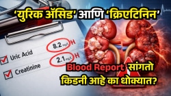 रिपोर्टमध्ये ‘युरिक ॲसिड’ आणि ‘क्रिएटिनिन’ वाढले? Blood Report सांगतो किडनी आहे का धोक्यात?