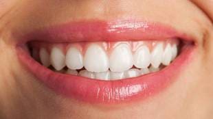 Natural Teeth Whitening
