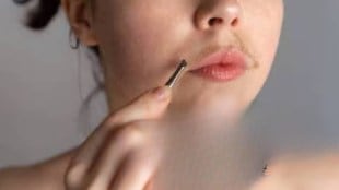 PCOS facial hair remedies, natural ways to reduce facial hair in PCOS