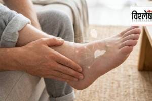 Swollen feet indicating potential heart or kidney failure symptoms