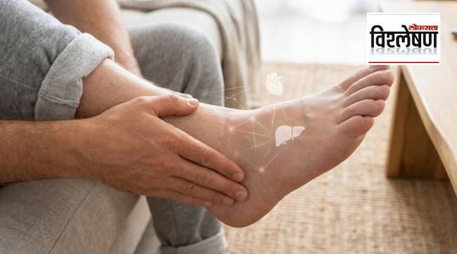 Swollen feet indicating potential heart or kidney failure symptoms