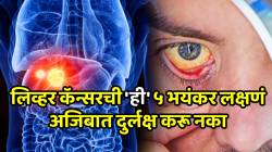 भूक कमी लागते? पोटाच्या उजव्या बाजूला दुखतं? लिव्हर कॅन्सरची ‘ही’ ५ भयंकर लक्षणं अजिबात दुर्लक्ष करू नका, डॉक्टरांनी दिला इशारा