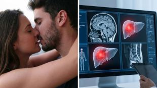 kissing-disease-new-virus-saliva-transmission-oral-hygiene-health-alert-2026