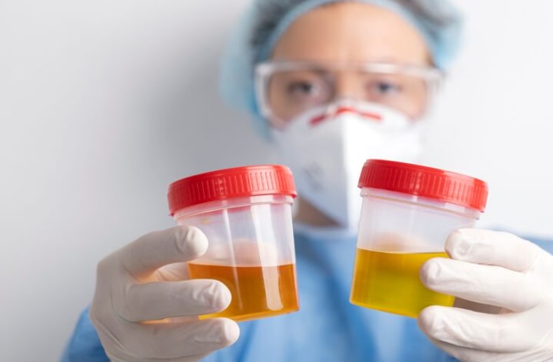 Different Shades Of Urine Does White Urine Means You Are Suffering From Diabetes What The Color Of Your Pee mean