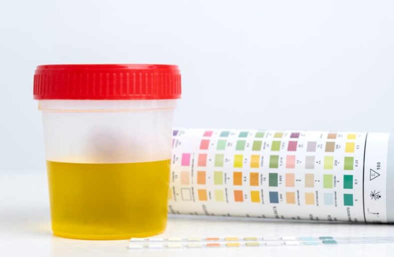 Different Shades Of Urine Does White Urine Means You Are Suffering From Diabetes What The Color Of Your Pee mean